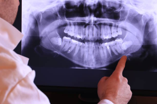 Best Root Canal Emergency Dentist  in Huntingtown, MD